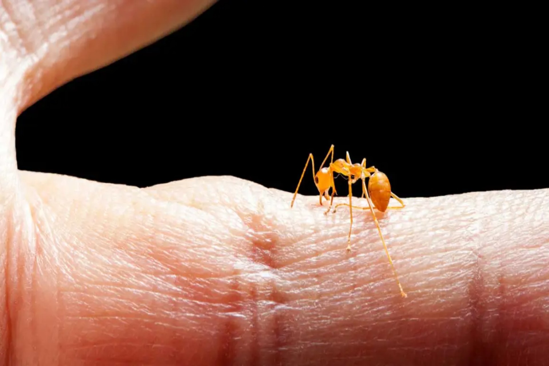 How to Get Rid of Ant Bites Overnight: Everything You Need to Know