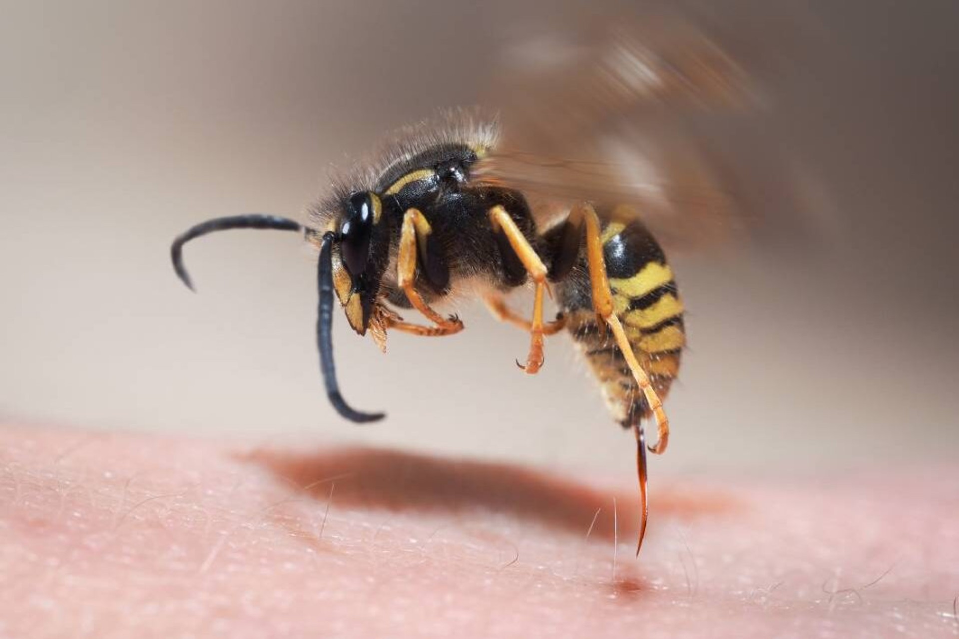 Wasp Stings and Allergies: When to Worry